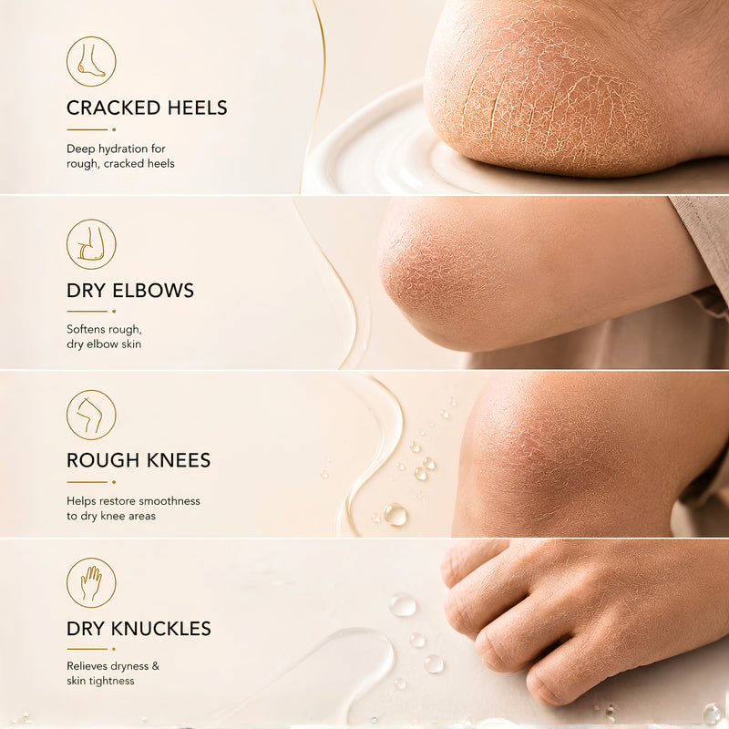 Dewsol Urea Cream with Glycolic Acid | Intensive Moisturiser for Cracked Heels & Dry Skin