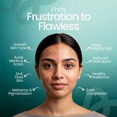 Kojiska Cream for Pigmentation | Skin Brightening & UV Protection Cream - Kojic Acid Dipalmitate & Glutathione